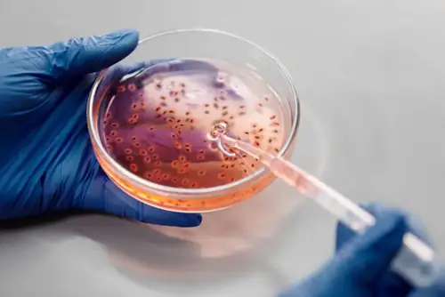FDA's Lettuce Test Was Wrong While 1,600+ People Got Explosive Diarrhea