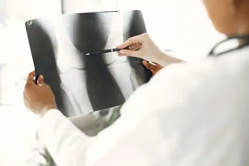 Six Kids in One California Suburb All Got the Same Rare Bone Cancer