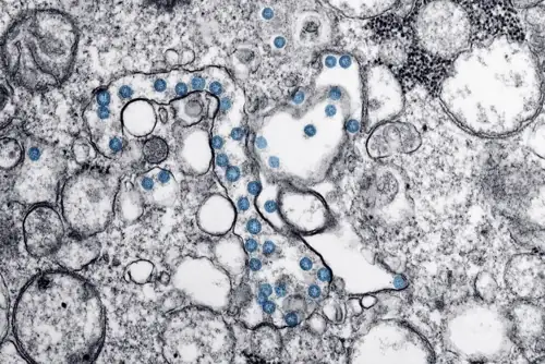 One Dead as Legionnaires' Outbreak Hits NYC's Priciest Zip Code