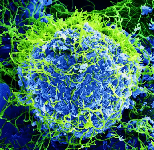 Ebola Is Killing People in Congo and the World Is Barely Watching