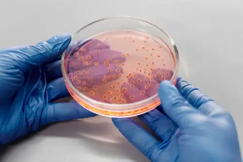 USDA Kills Cyclospora Research Mid-Outbreak After 17,000 Fall Sick
