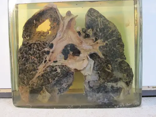 1-in-3 Veteran Coal Miners Now Have Black Lung — Worst Rate Since 1978