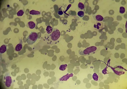 Parasite Hits 31 States and Nobody Knows What Food Is Doing It