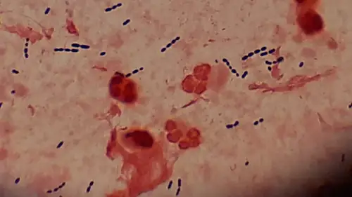 A Poop Parasite Is Tearing Through 31 States and Nobody Knows Why