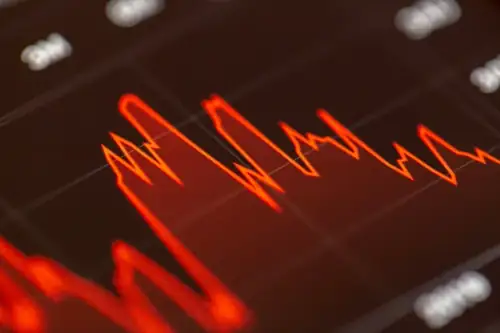 The 30-Year Treasury Just Hit Its Worst Level Since 2007 and Your Mortgage Is Next