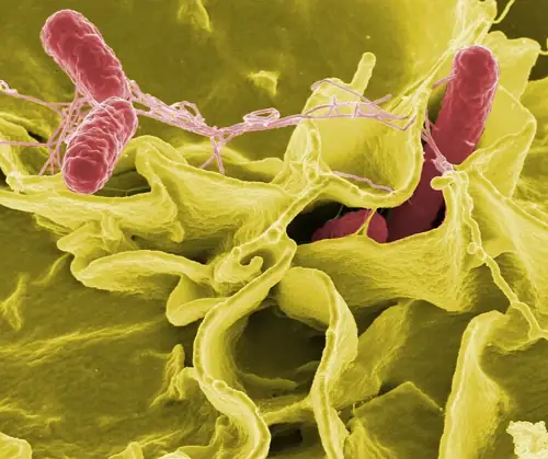 Cyclospora Outbreak
