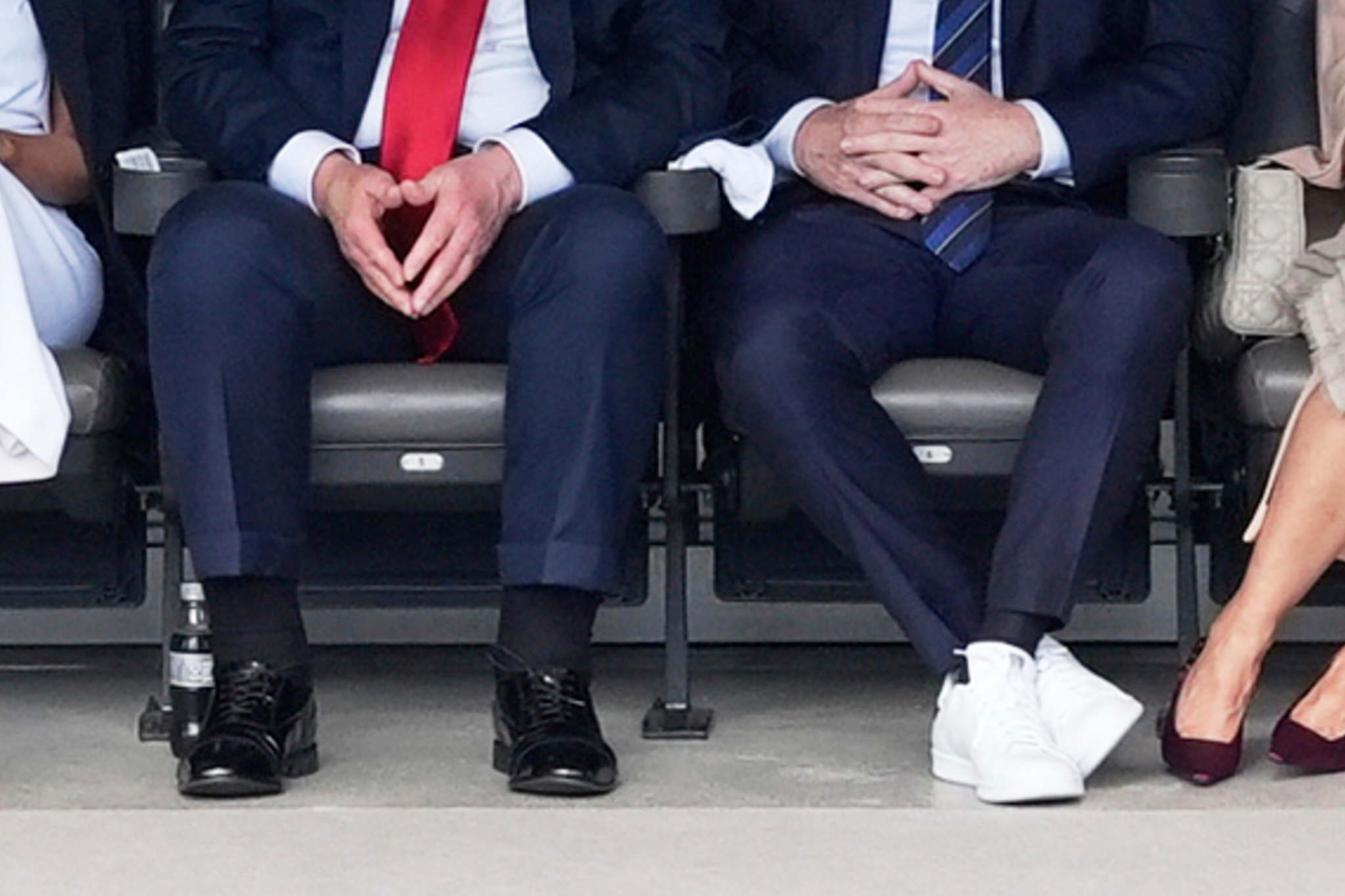 Trump's swollen legs (left)